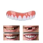 Вініри для зубів Perfect Smile Veneers знімні, міцні, накладка на зуби для красивої посмішки