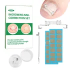 Коректор врослого нігтя Ingrowing Nail Correction Set